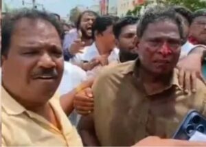 உதயநிதி கைதின்போது திமுக தொண்டரை ரத்தம் சொட்ட சொட்ட அடித்த போலீஸ்!!